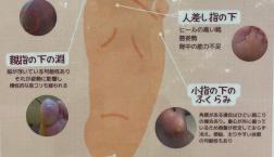 実は大事！足の裏(^^)/