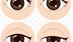 それって、眼瞼下垂??(≧◇≦)